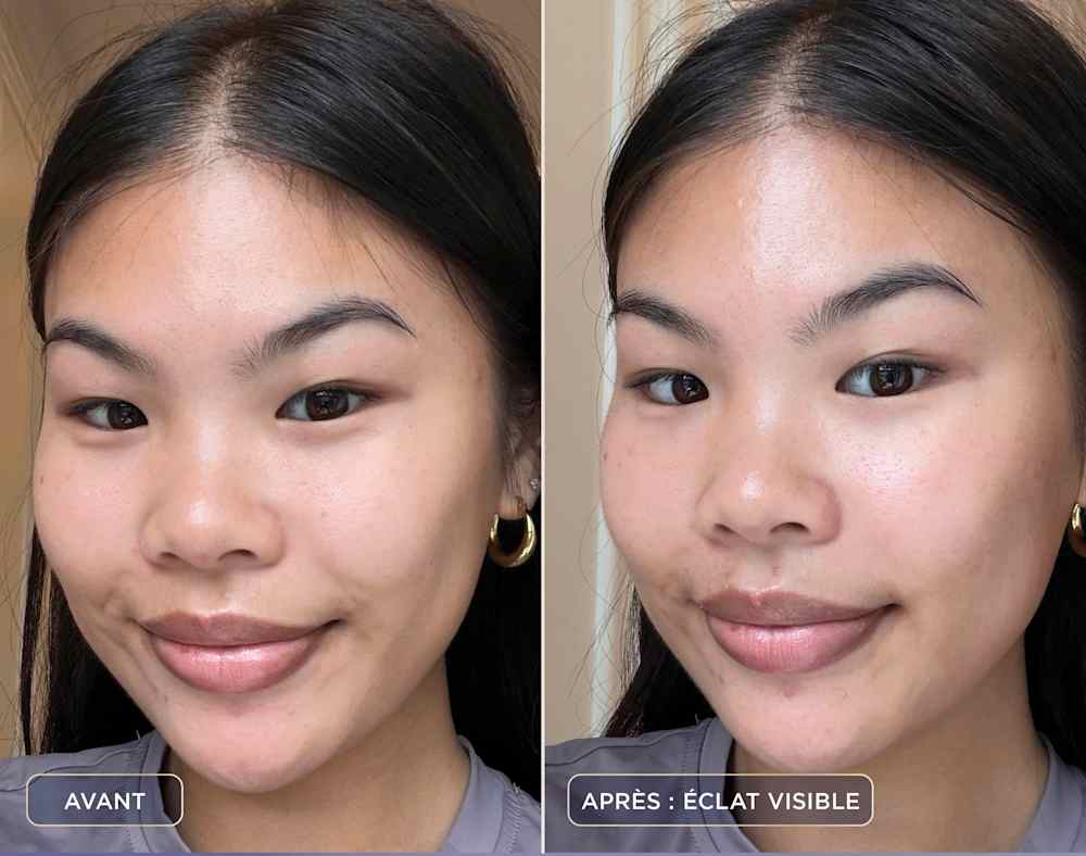 Photo montrant un avant/apr&egrave;s des imperfections apr&egrave;s utilisation de l'appareil de soin FacialPro Glow