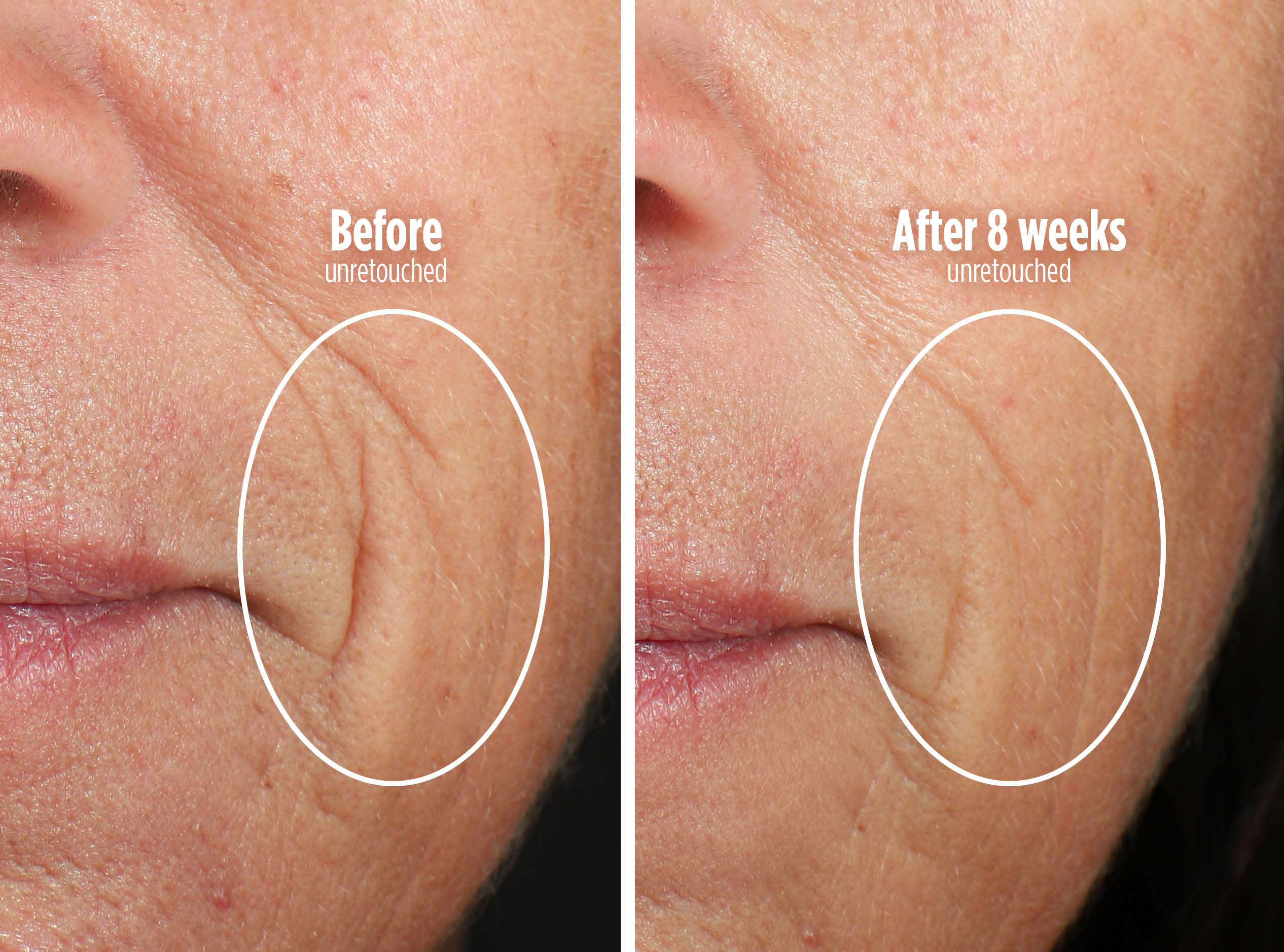 Minimize fine lines in 8 weeks