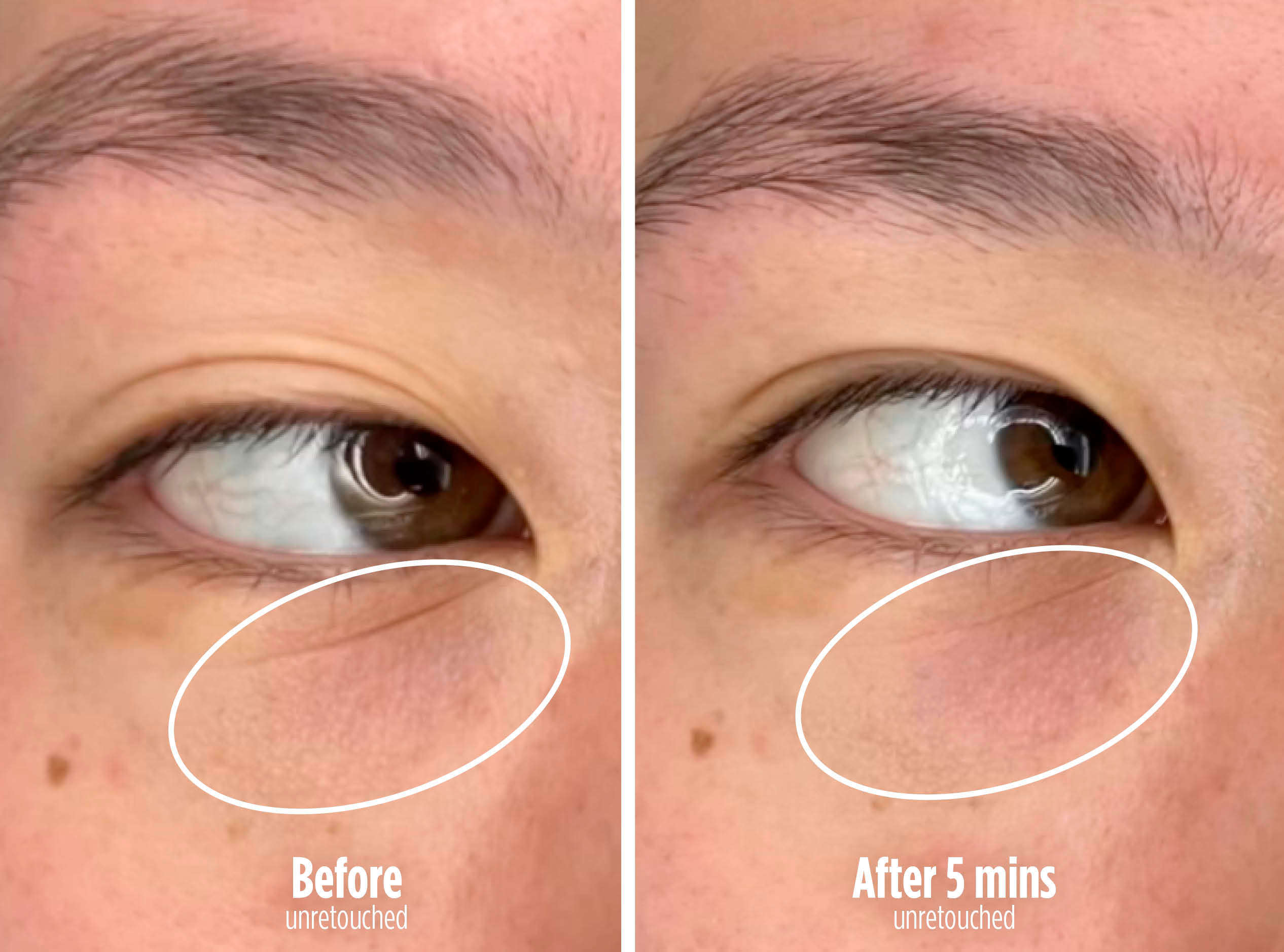Visibly tighten under-eyes