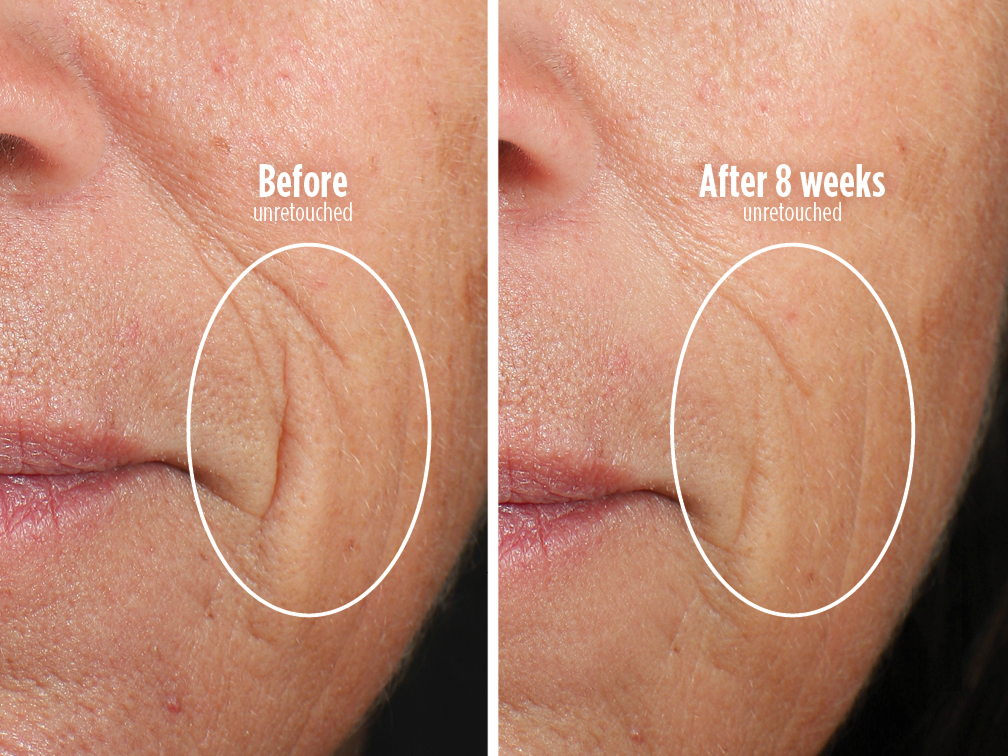 Firmer skin in 8 weeks.