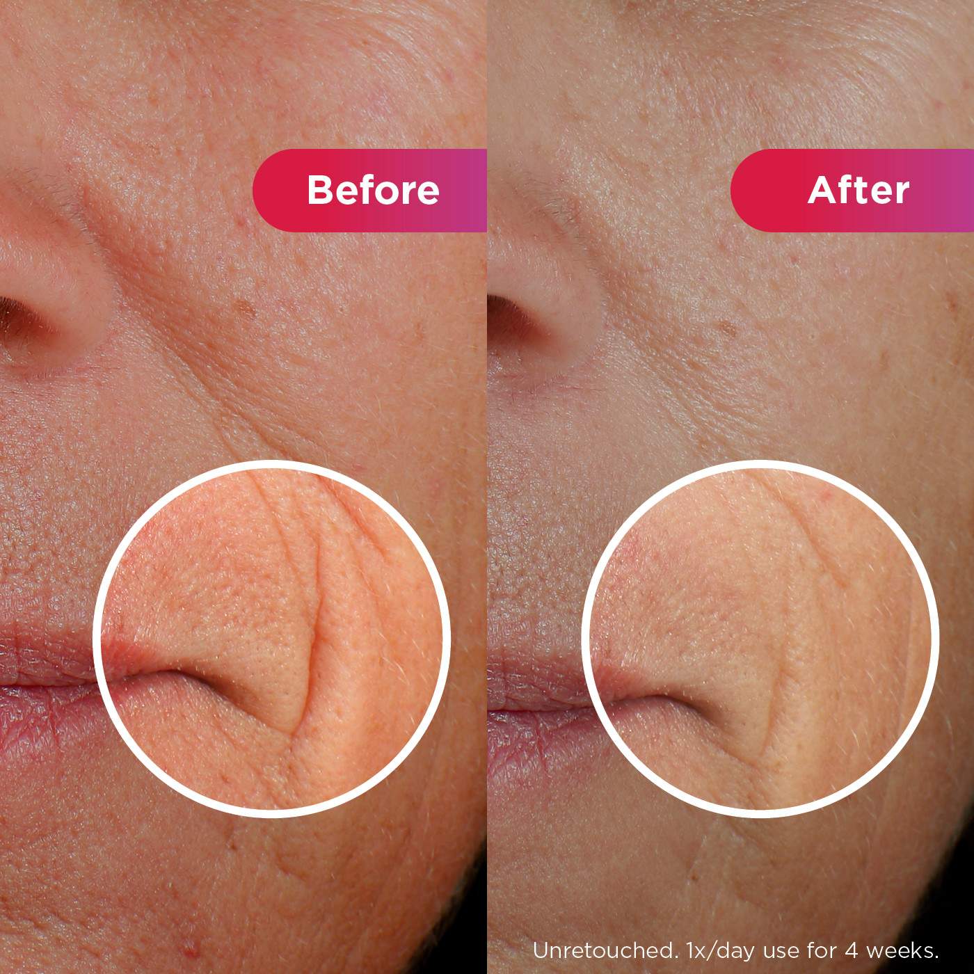 Image of Better Ageing Before and After