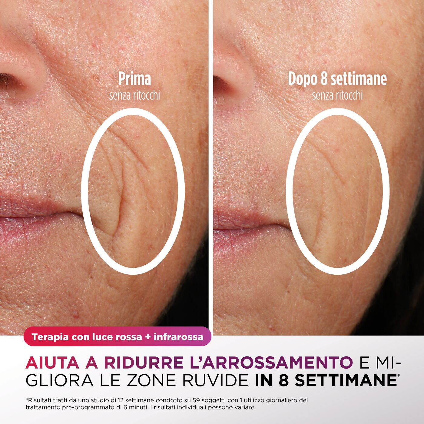 Immagine della Terapia con luce rossa + infrarossa